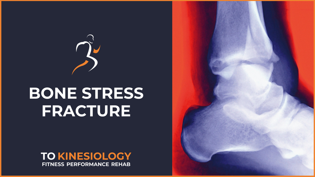 Bone stress fracture 